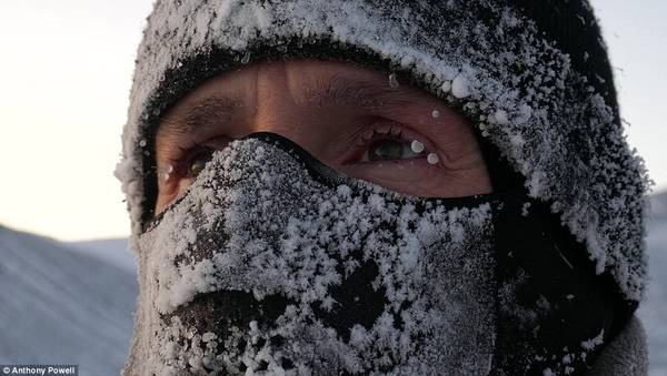 Độ ẩm không khí tại Nam Cực bằng 0, và nếu có chút hơi ẩm nào, lập tức nó sẽ bị đóng băng. Bức ảnh chụp Anthony đeo chiếc mũ kín mặt và hơi thở của ông bị đóng băng tại chỗ.