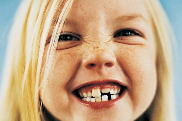 Ở Hy Lạp và Mauritania, trẻ em không đặt răng dưới gối chờ tiên răng tới lấy mà ném thật mạnh lên nóc nhà để được may mắn và khỏe mạnh. 