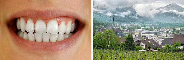 Liechtenstein là nước sản xuất răng giả lớn nhất thế giới