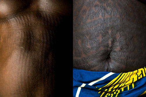 Ngoài mặt, bụng và lưng là nơi được nhiều người dân chọn để rạch tạo sẹo nhất. Ảnh: Ethioscoop.